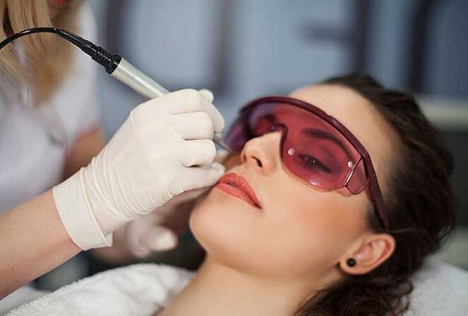 Laserbiorevitalisierung