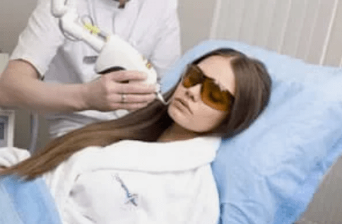 fraktionierte Lasererneuerung